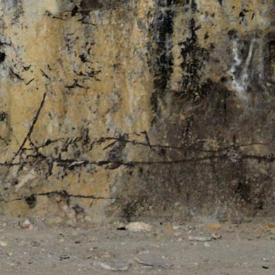 Arnaud Théval et K. Hurler calmement. Institut Bergonié, Bordeaux.